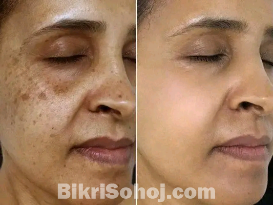 Orange Exfoliating Whitening Gel